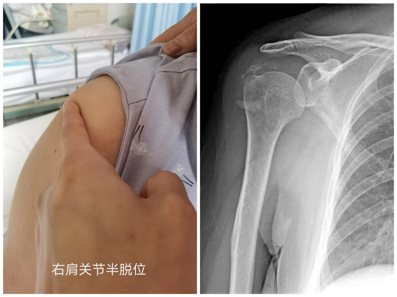 26154142hp6j.png 26154142hp6j.png